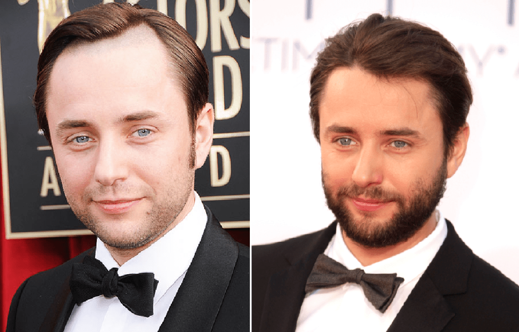 mad-men-season-seven-pete-campbell-vincent-kartheiser-hairline-shaved